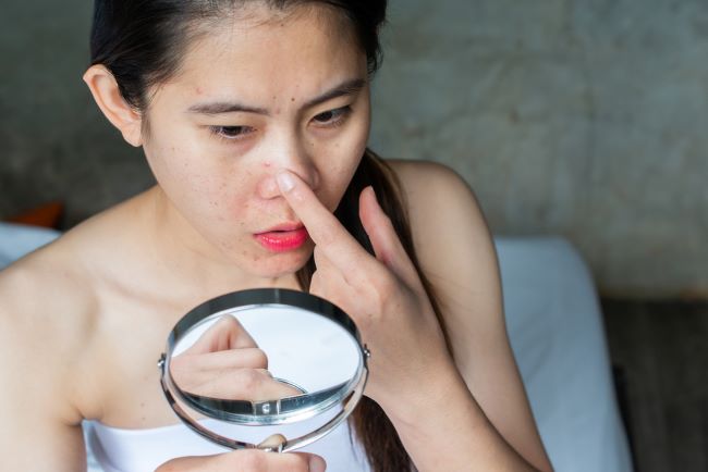 Penyebab Masalah Jerawat di Hidung dan Cara Mengatasinya